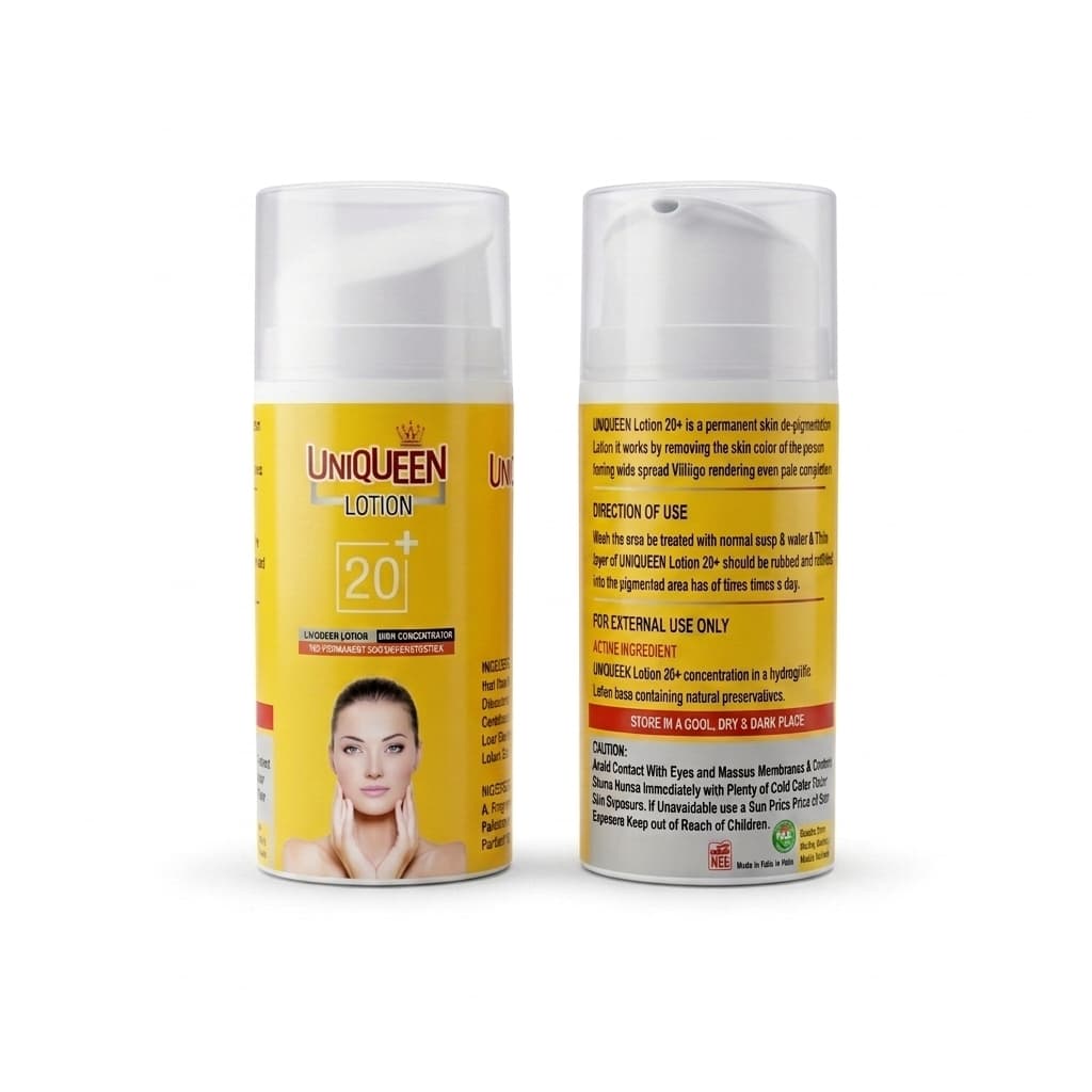 UNIQUEEN Lotion 20+ - Micronized MBEH 20% | Permanent Skin Depigmentation Lotion | Buy UNIQUEEN Online